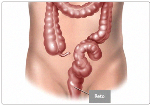 Imagem de intestino apontando a área do reto, representando a retossigmoidoscopia rígida